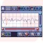 Portable Surface Roughness Tester Surftest SJ-310 SERIES 178 | MITUTOYO